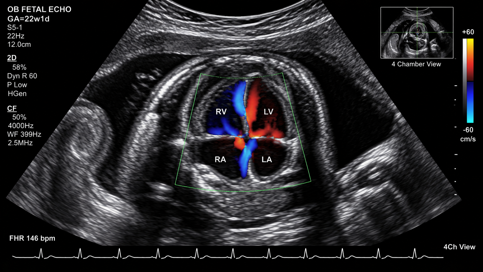 Fetal echocardiography scan
